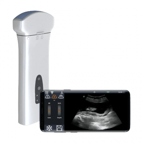 Портативная УЗ-система Delta D8, 4 датчика, планшет, беспроводная, начальный класс